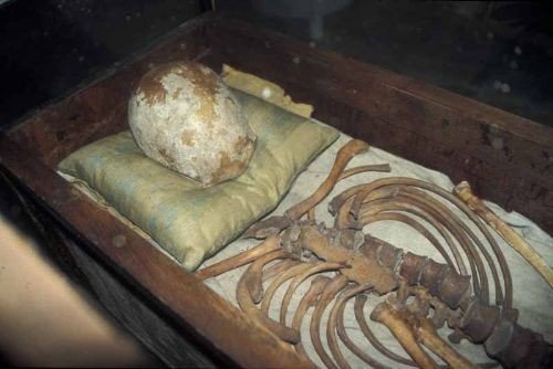 skeletal remains of King Knud